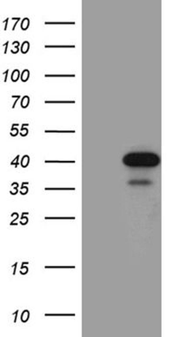 SULT1A3 Antibody in Western Blot (WB)