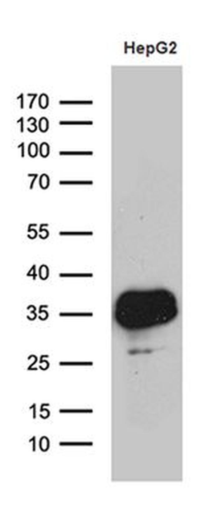 SULT1A3 Antibody in Western Blot (WB)