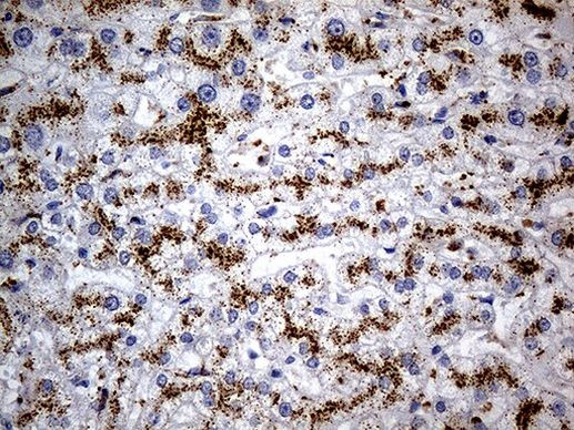 NAGA Antibody in Immunohistochemistry (Paraffin) (IHC (P))