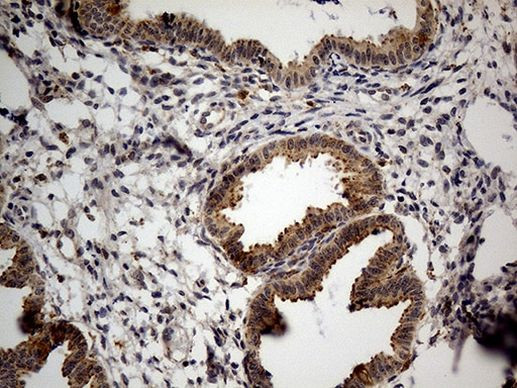 NAGA Antibody in Immunohistochemistry (Paraffin) (IHC (P))