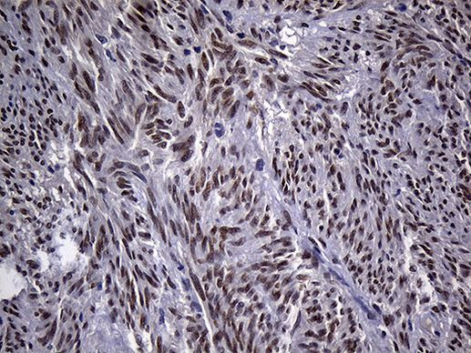 ZBTB4 Antibody in Immunohistochemistry (Paraffin) (IHC (P))