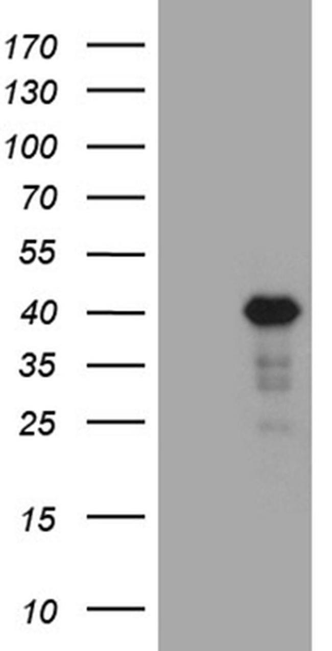 LIMS2 Antibody in Western Blot (WB)