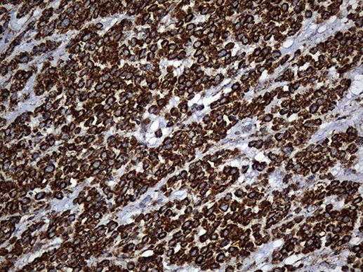 UQCRFS1 Antibody in Immunohistochemistry (Paraffin) (IHC (P))