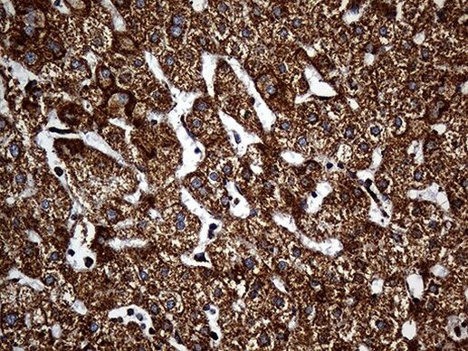 UQCRFS1 Antibody in Immunohistochemistry (Paraffin) (IHC (P))