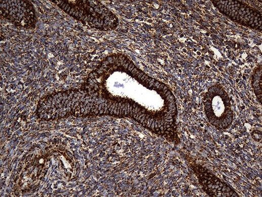 UQCRFS1 Antibody in Immunohistochemistry (Paraffin) (IHC (P))