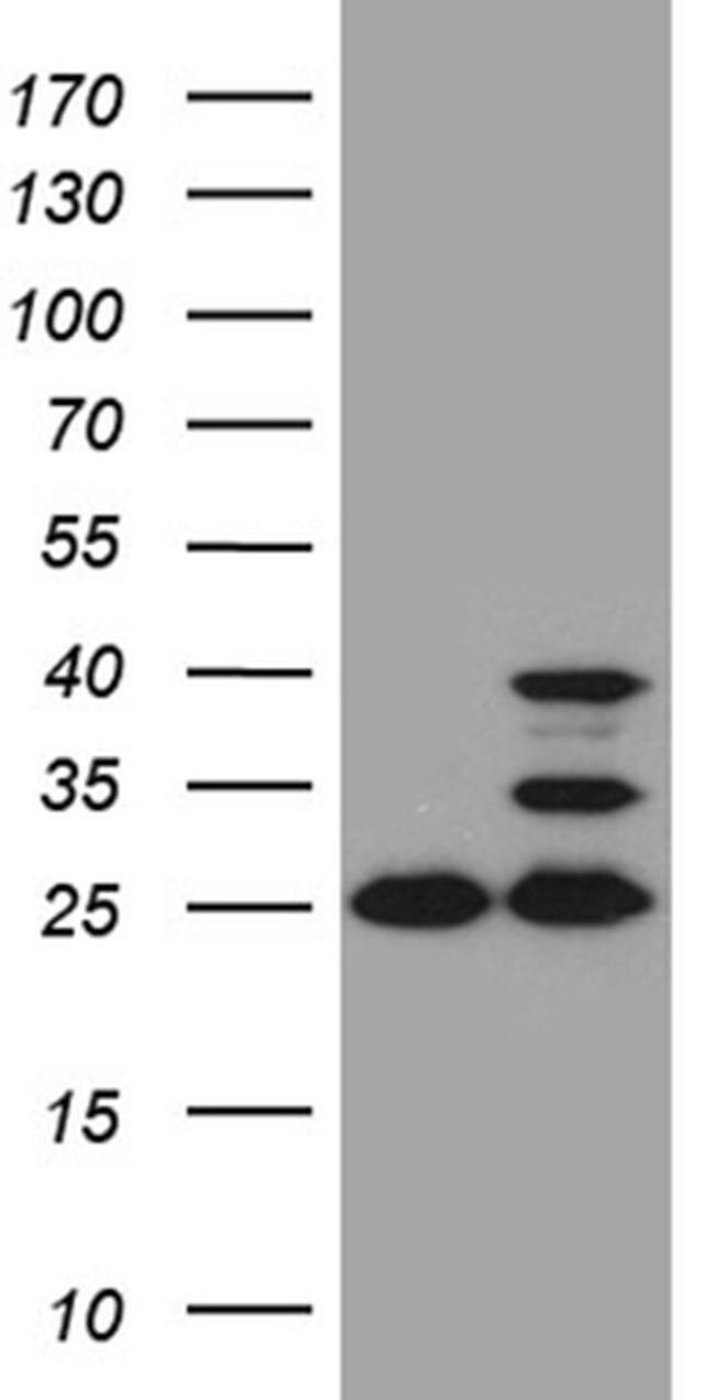 UQCRFS1 Antibody in Western Blot (WB)