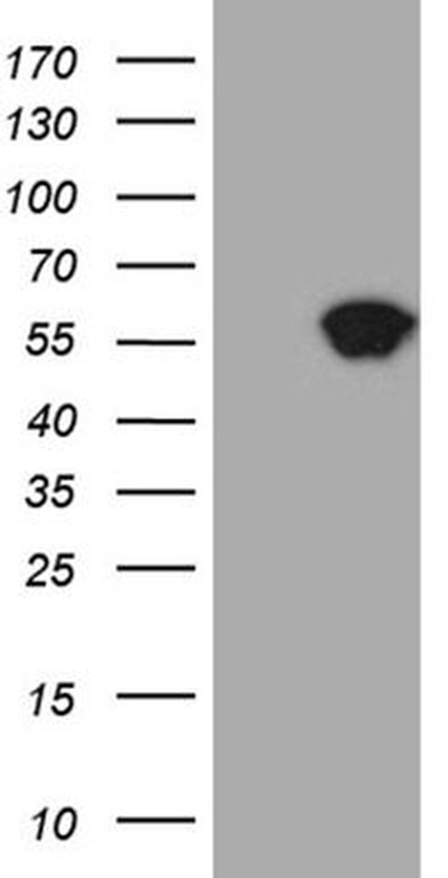 Staufen Antibody in Western Blot (WB)