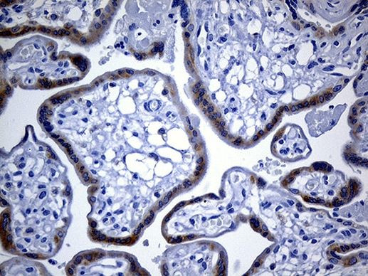 IGF2BP3 Antibody in Immunohistochemistry (Paraffin) (IHC (P))