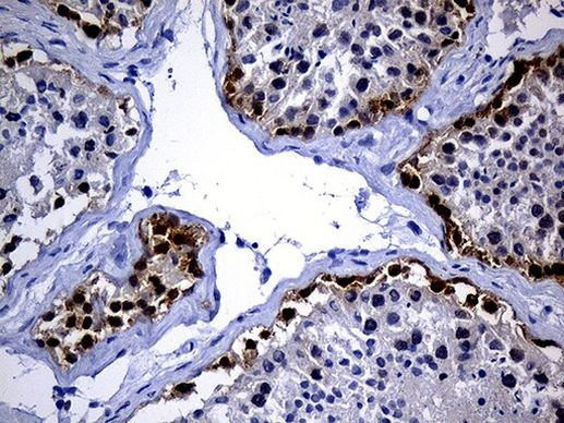 IGF2BP3 Antibody in Immunohistochemistry (Paraffin) (IHC (P))