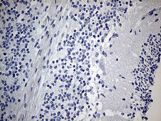 IGF2BP3 Antibody in Immunohistochemistry (Paraffin) (IHC (P))