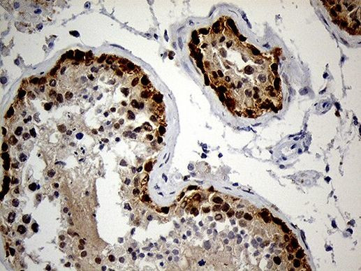 IGF2BP3 Antibody in Immunohistochemistry (Paraffin) (IHC (P))