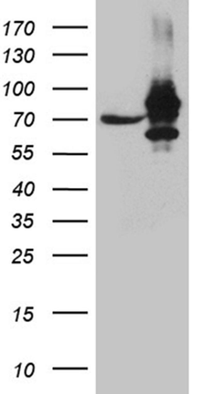 IGF2BP3 Antibody in Western Blot (WB)