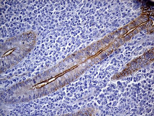 C14orf80 Antibody in Immunohistochemistry (Paraffin) (IHC (P))