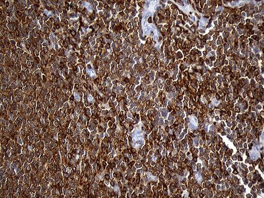 SH3BP1 Antibody in Immunohistochemistry (Paraffin) (IHC (P))