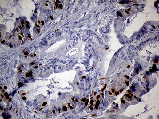 RACGAP1 Antibody in Immunohistochemistry (Paraffin) (IHC (P))