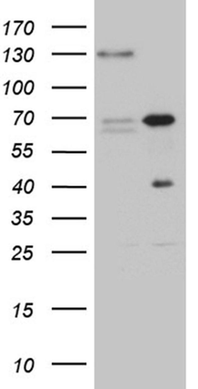 ZNF655 Antibody in Western Blot (WB)