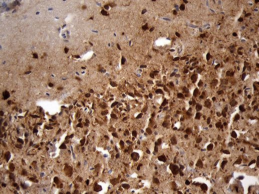 EEF1D Antibody in Immunohistochemistry (Paraffin) (IHC (P))