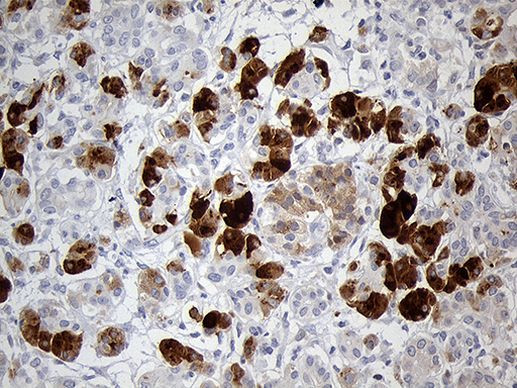 PNLIP Antibody in Immunohistochemistry (Paraffin) (IHC (P))