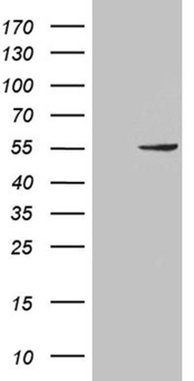 PNLIP Antibody in Western Blot (WB)