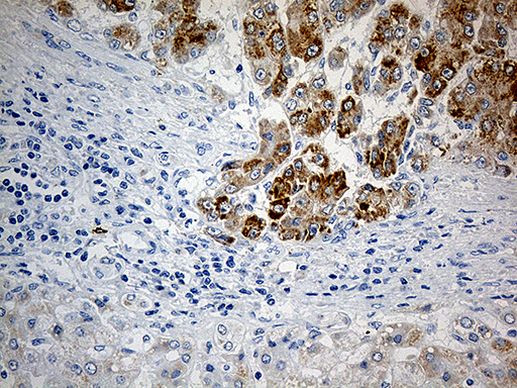 PYCR1 Antibody in Immunohistochemistry (Paraffin) (IHC (P))