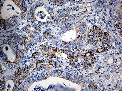 PYCR1 Antibody in Immunohistochemistry (Paraffin) (IHC (P))