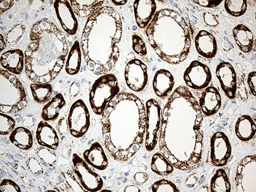 ACADM Antibody in Immunohistochemistry (Paraffin) (IHC (P))