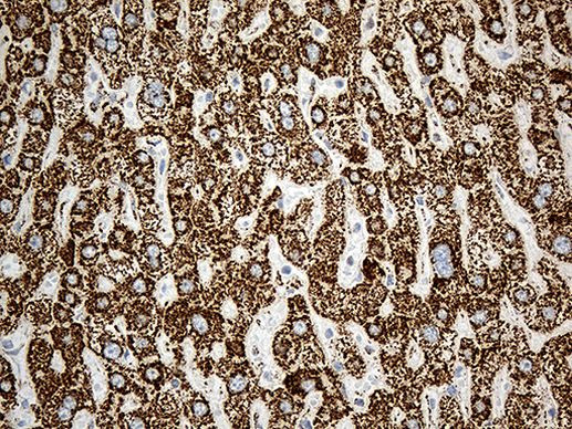 ACADM Antibody in Immunohistochemistry (Paraffin) (IHC (P))