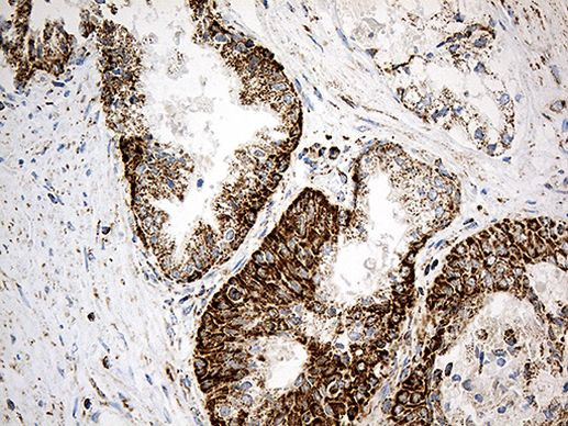 ACADM Antibody in Immunohistochemistry (Paraffin) (IHC (P))