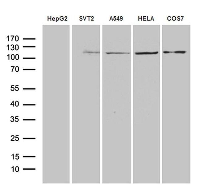 IDE Antibody in Western Blot (WB)