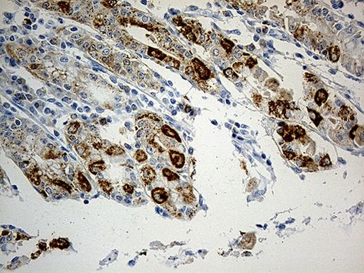 CHCHD10 Antibody in Immunohistochemistry (Paraffin) (IHC (P))