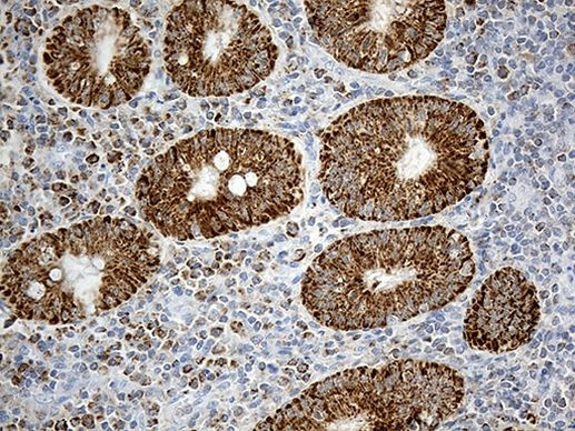 CHCHD10 Antibody in Immunohistochemistry (Paraffin) (IHC (P))