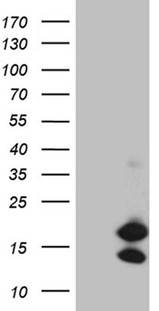 CHCHD10 Antibody in Western Blot (WB)