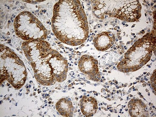 RPL7A Antibody in Immunohistochemistry (Paraffin) (IHC (P))