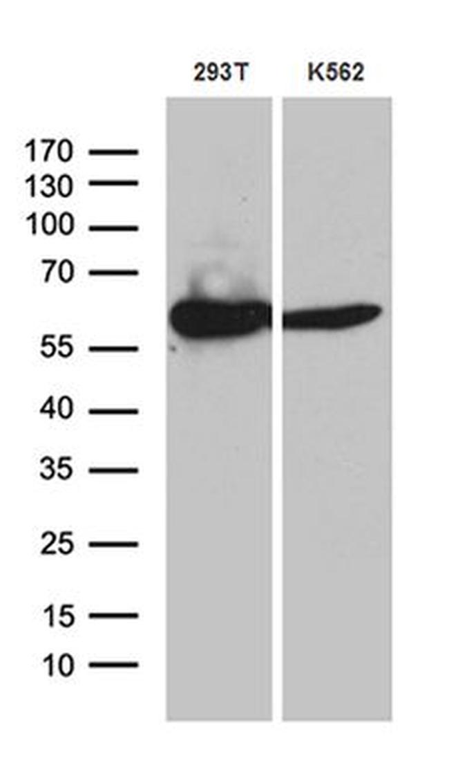 ACAD9 Antibody in Western Blot (WB)