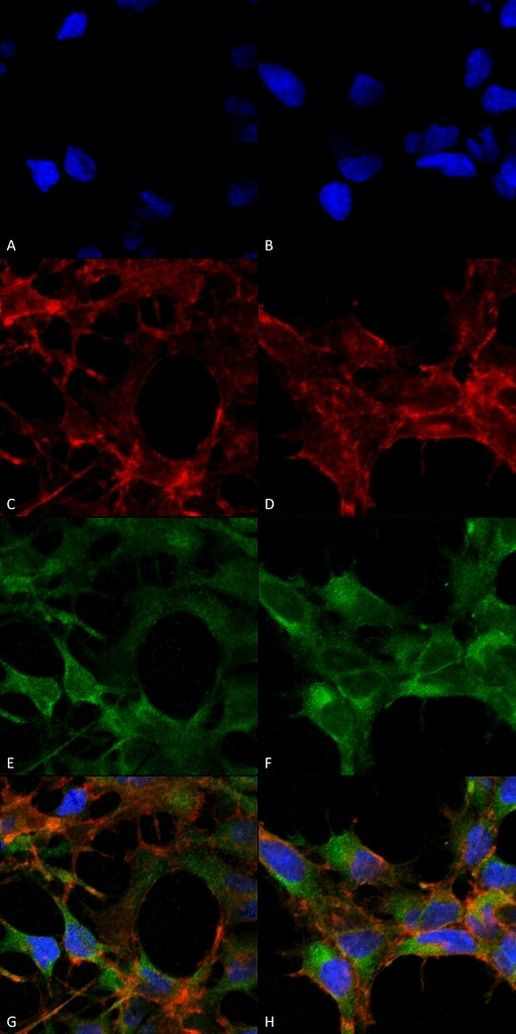 Acrolein Antibody in Immunocytochemistry (ICC/IF)