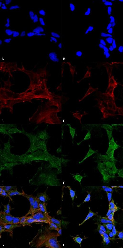 4-Hydroxy-2-hexenal Antibody in Immunocytochemistry (ICC/IF)