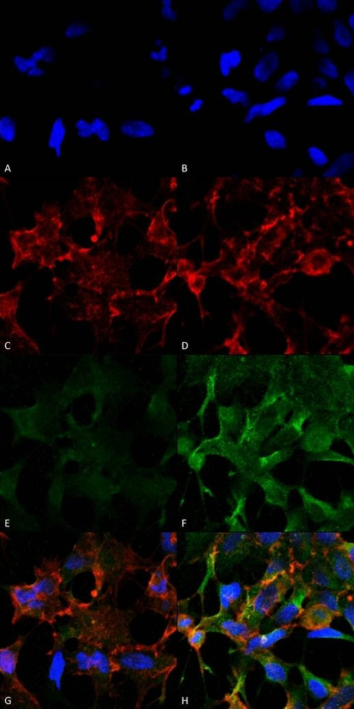 Acrolein Antibody in Immunocytochemistry (ICC/IF)