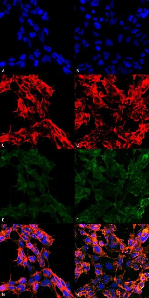 7-Ketocholesterol Antibody in Immunocytochemistry (ICC/IF)