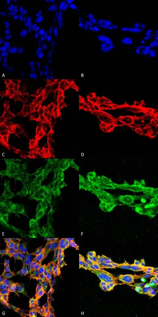 7-Ketocholesterol Antibody in Immunocytochemistry (ICC/IF)