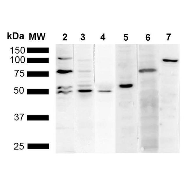 KDEL Antibody in Western Blot (WB)