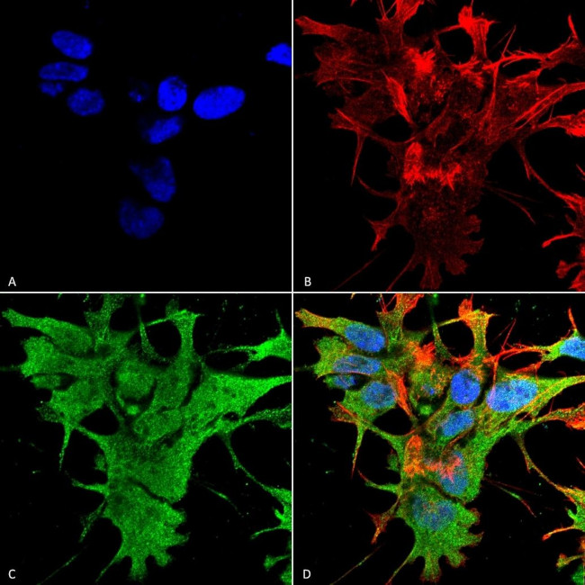 Dicer Antibody in Immunocytochemistry (ICC/IF)