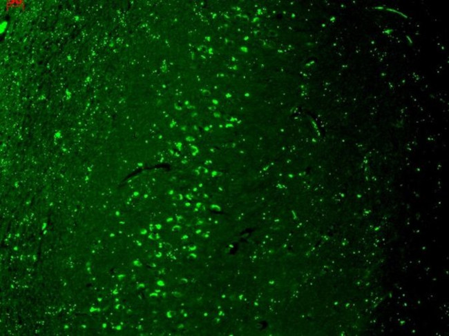 TRPV3 Antibody in Immunohistochemistry (Paraffin) (IHC (P))