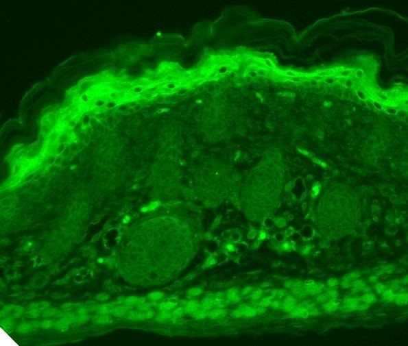 TRPV3 Antibody in Immunohistochemistry (Paraffin) (IHC (P))