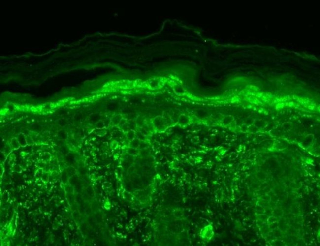 TRPV3 Antibody in Immunohistochemistry (Paraffin) (IHC (P))