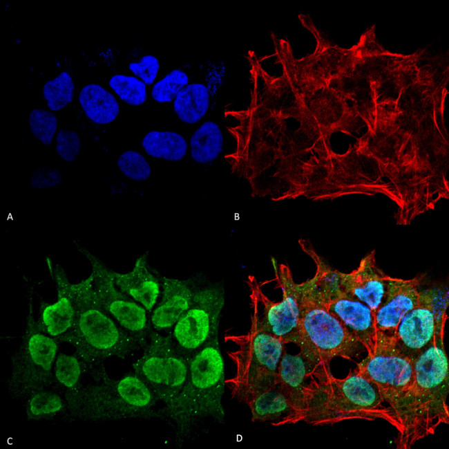 SHANK3 Antibody in Immunocytochemistry (ICC/IF)