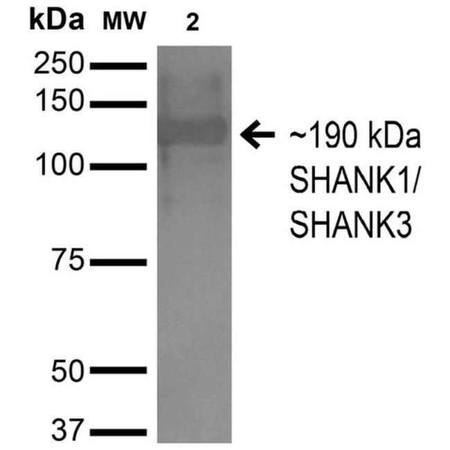 SHANK3 Antibody in Western Blot (WB)