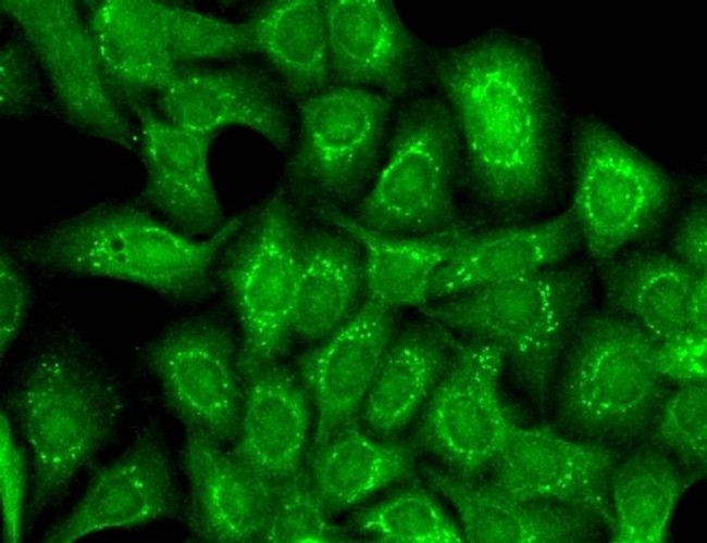 KCNT1 Antibody in Immunocytochemistry (ICC/IF)