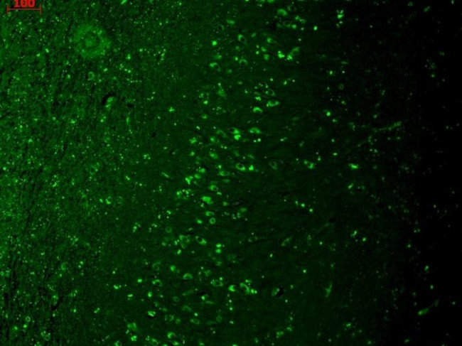 TRPM7 Antibody in Immunohistochemistry (Paraffin) (IHC (P))