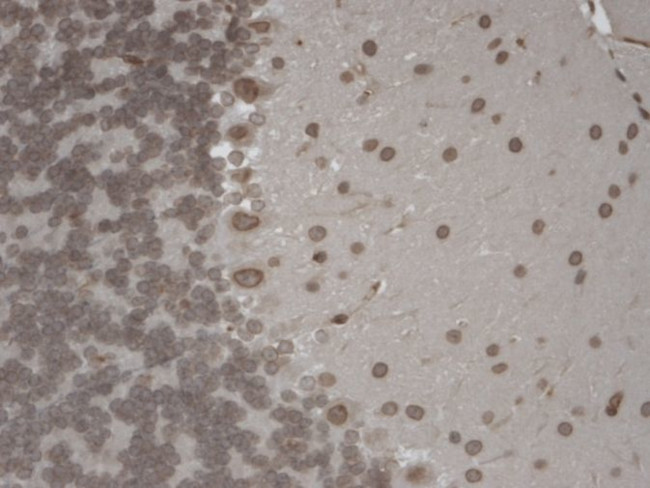 TRPM7 Antibody in Immunohistochemistry (Paraffin) (IHC (P))