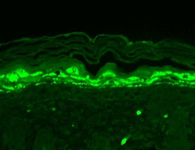 SHANK1 Antibody in Immunohistochemistry (Paraffin) (IHC (P))